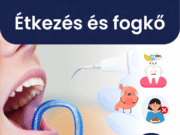 Hogyan szól bele az étkezésbe a fogkő?